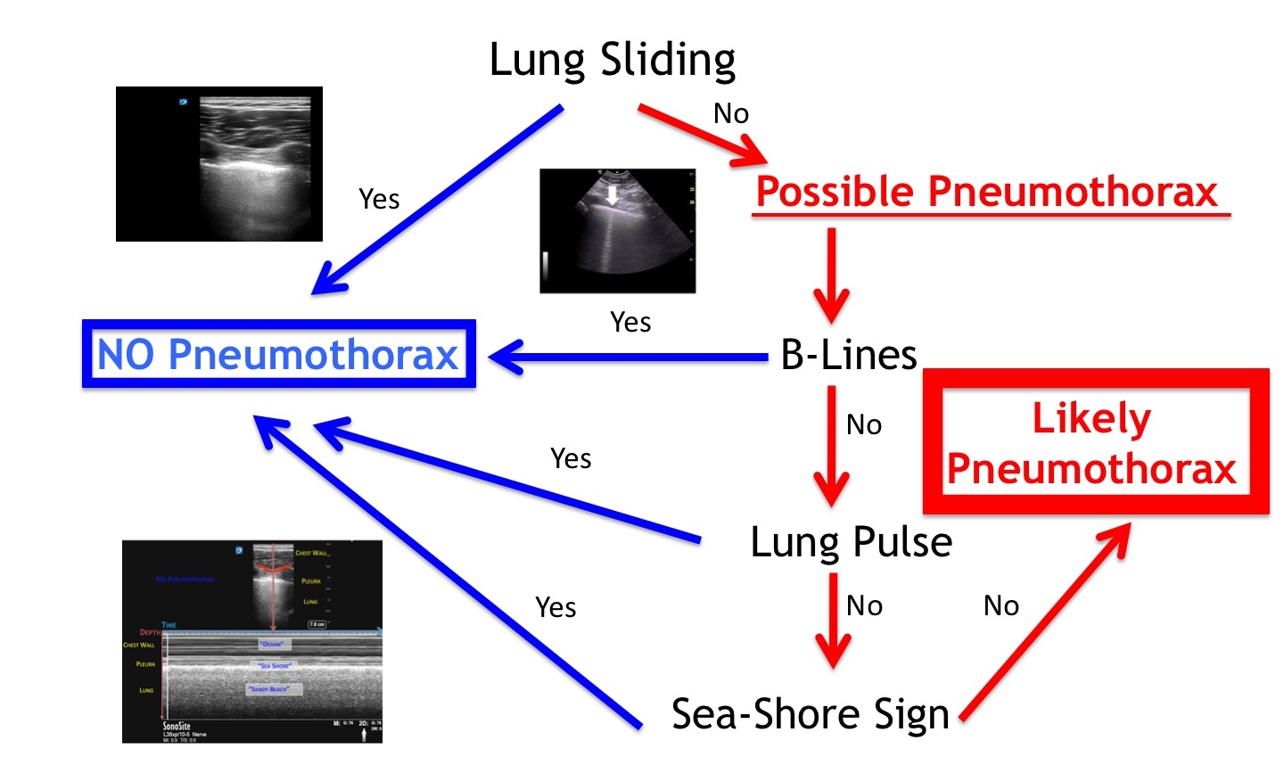 Pneumothorax flow chart