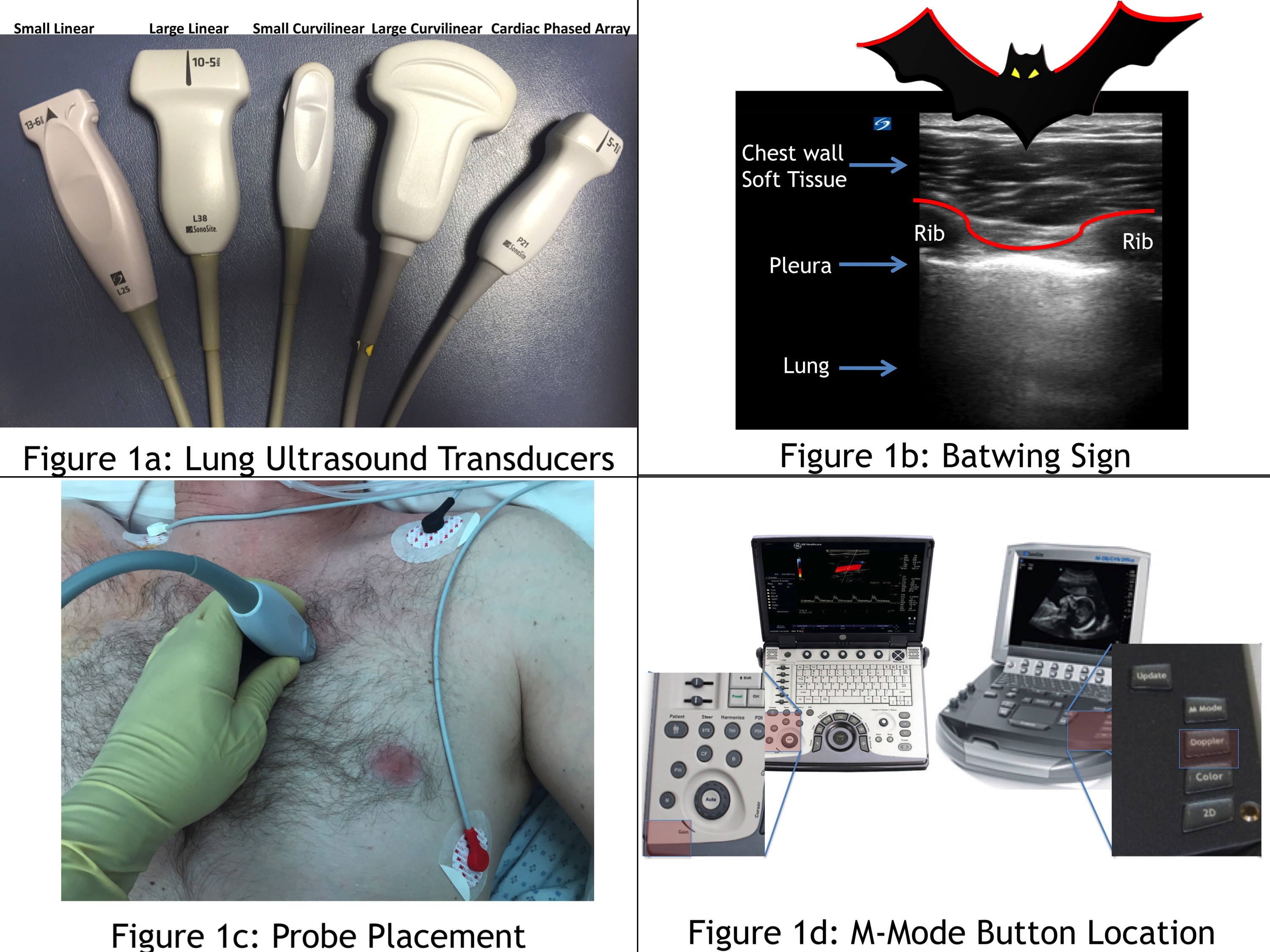 Lung Ultrasound Transducers