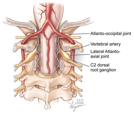 cervicogenic-headache-atlantoaxial-and-atlantoccipital-joints
