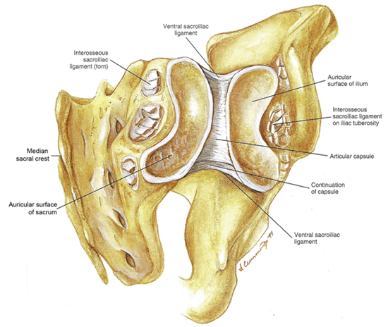 sacroiliac-joint-pain-opened-si-joint