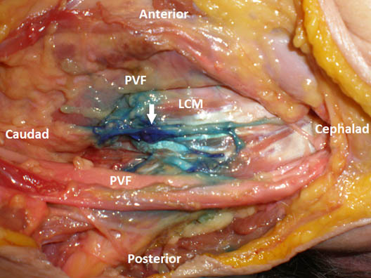 stellate-ganglion-block-cadaver-dissection