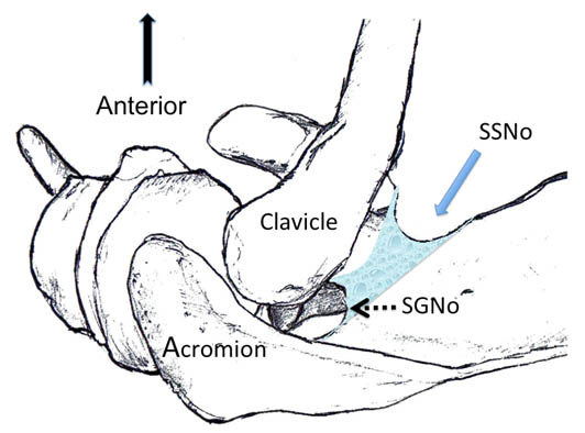 suprascapular-nerve-block-superior-view-of-the-left-shoulder