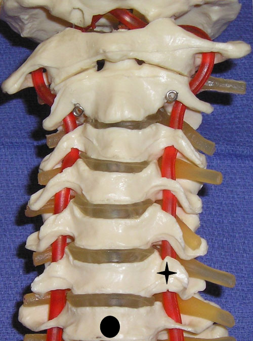 ultrasound-guided-axial-blocks-cervical-spine-model