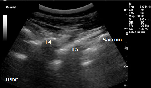 ultrasound-guided-axial-blocks-sonographic-long-axis-view