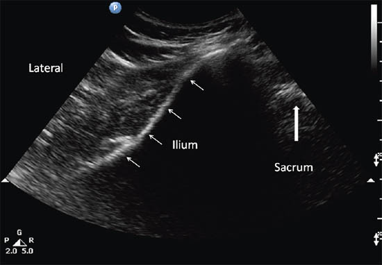 ultrasound-guided-block-for-peripheral-structures-underlying-structures
