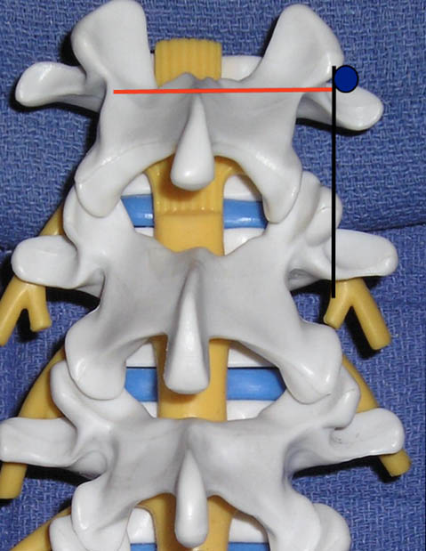 ultrasound-guided-lumbar-medial-branch-block-lumbar-medial-branch-blocks