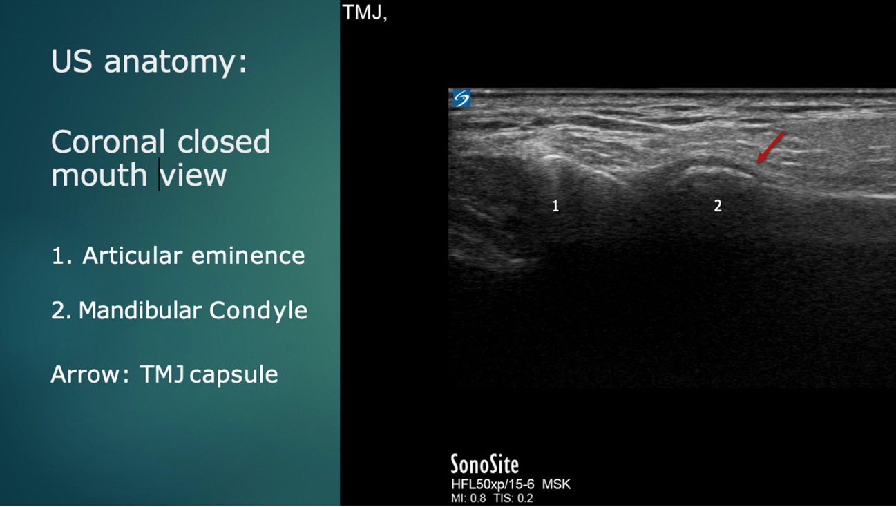Ultrasound anatomy: Coronal plane  ﻿