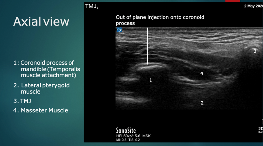 Ultrasound Anatomy: Transverse/Axial plane