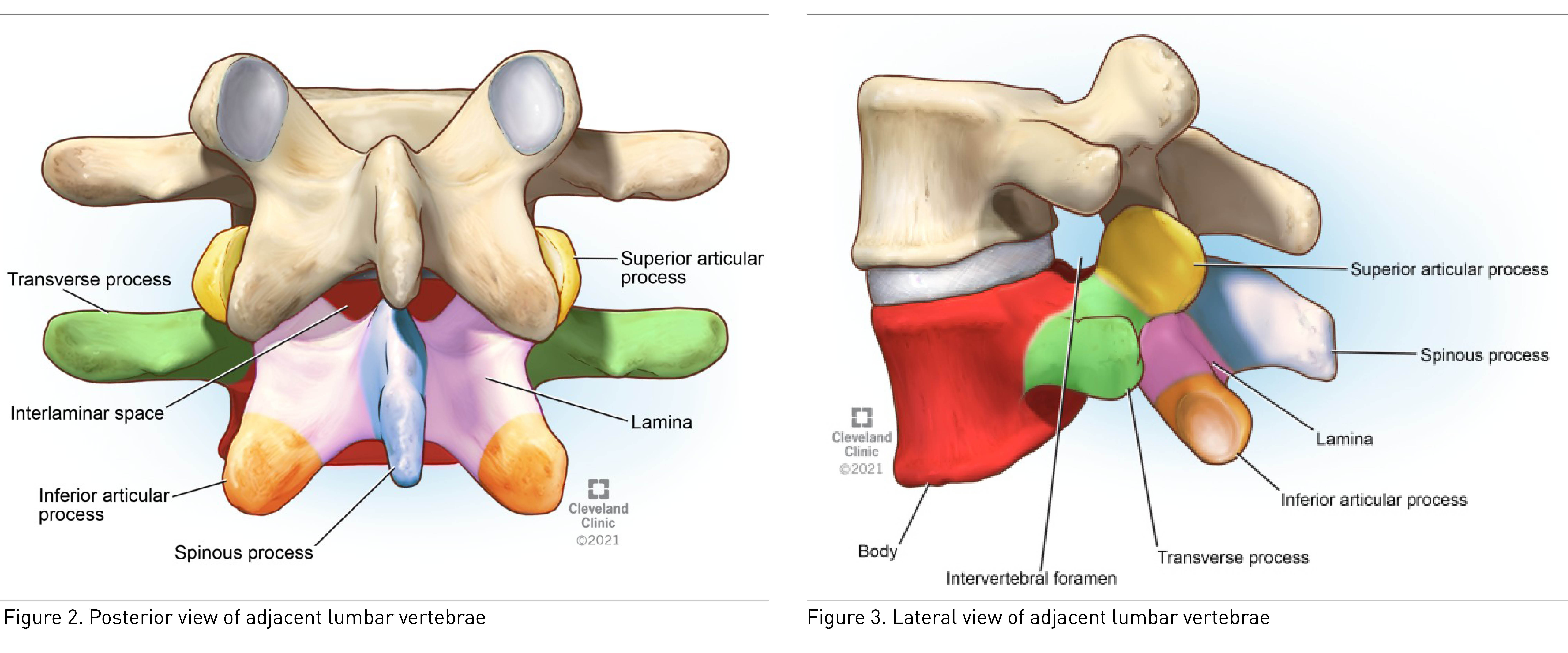 Posterior and lateral views of adjacent lumbar vertebrae